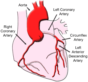 Major Coronary Heart Arteries. The Widow Make is upper right.